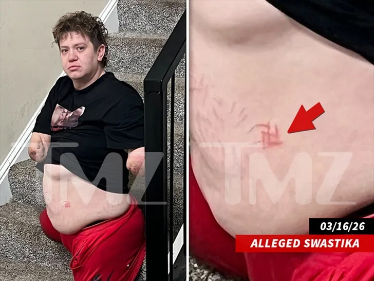 quadruple-amputee-murder-suspect-seen-with-swastika-on-belly-in-shocking-pic_69df955b0e314